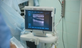 opciones de diagnóstico para las varices pélvicas